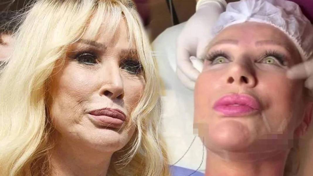 "Artık yeter" Öyle bir yerine estetik yaptırdı ki... Hayranları Seda Sayan'a isyan etti 3